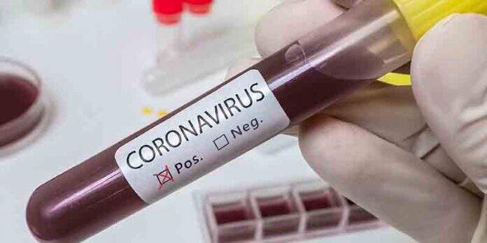 Coronavirus - NA
